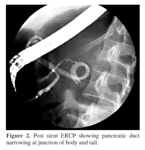 pancreas-showing-pancreatic-duct