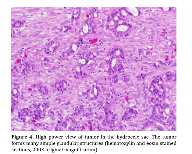 pancreas-simple-glandular-structures