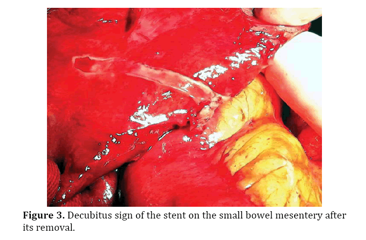 pancreas-small-bowel-mesentery