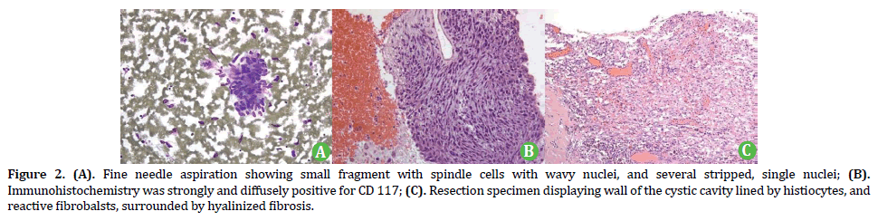 pancreas-small-fragment