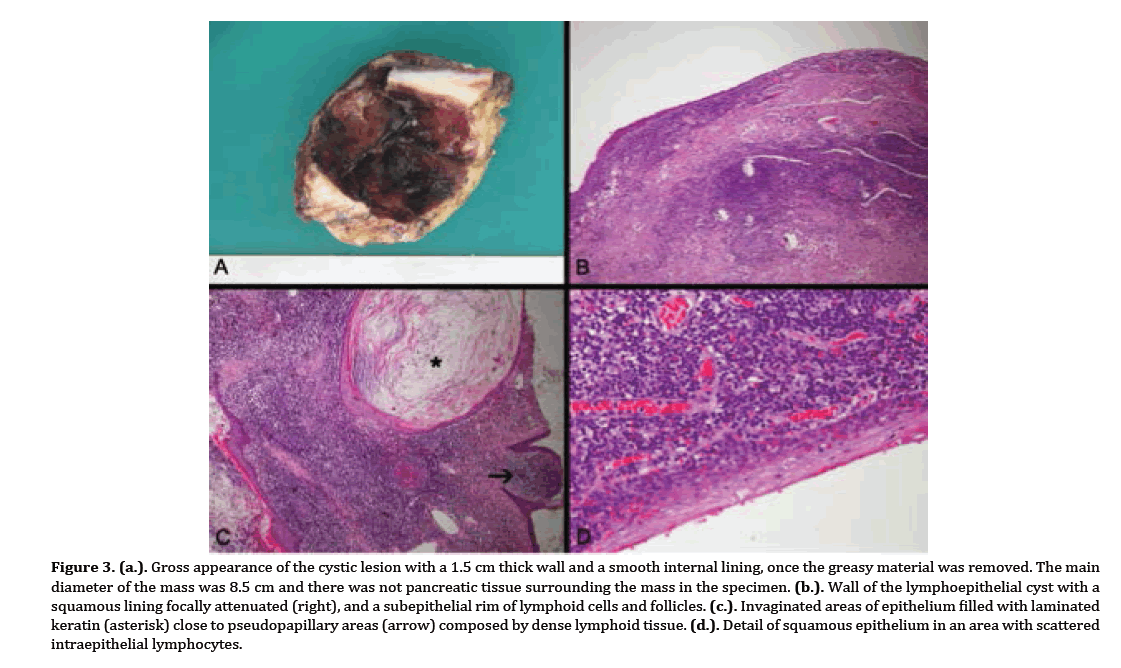 pancreas-smooth-internal-lining