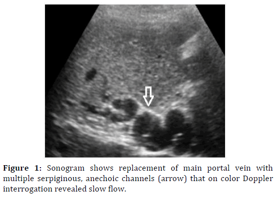 pancreas-sonogram-anechoic-channels