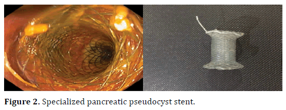 pancreas-specialized-pancreatic