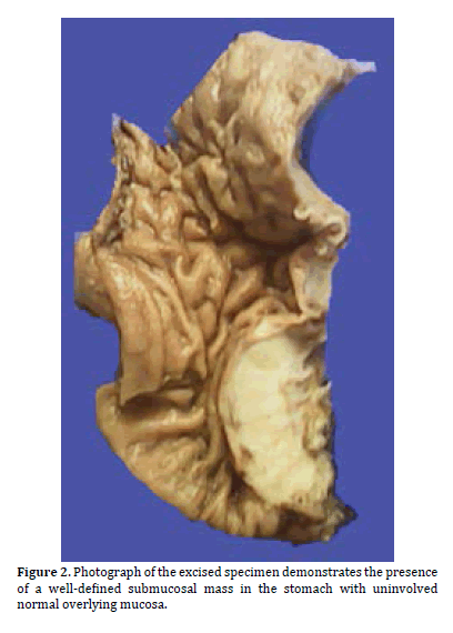 pancreas-specimen