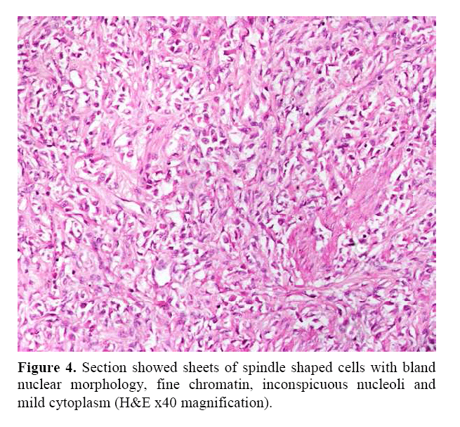 pancreas-spindle-shaped-cells