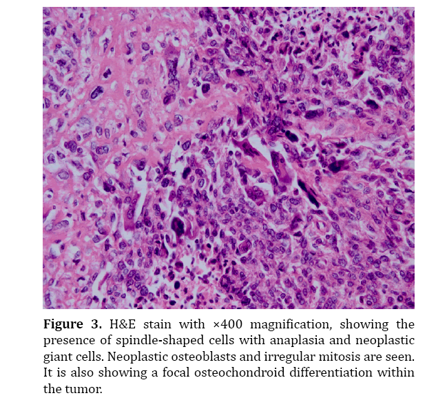 pancreas-spindle-shaped-cells