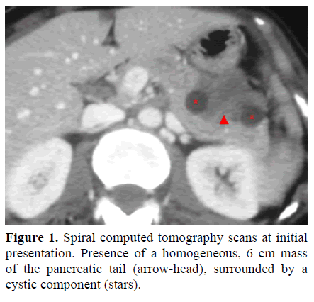 pancreas-spiral-computed-tomography