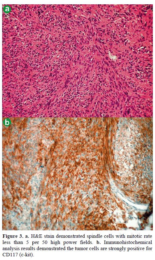 pancreas-stain-demonstrated-spindle