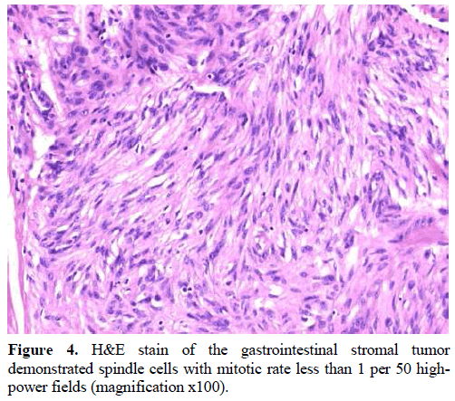 pancreas-stain-gastrointestinal-stromal