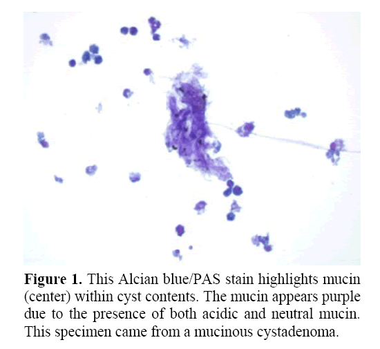 pancreas-stain-highlights-mucin