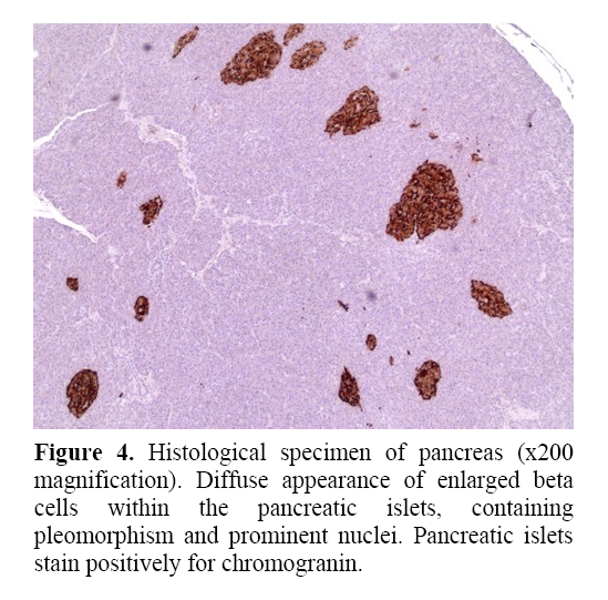 pancreas-stain-positively-chromogranin