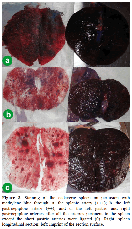 pancreas-staining-cadaveric-spleen