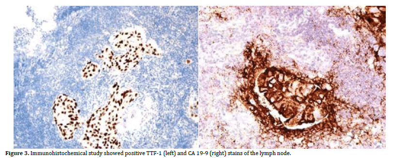 pancreas-stains