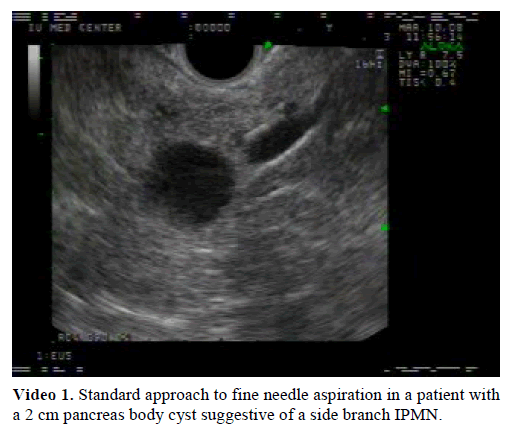 pancreas-standard-approach-needle