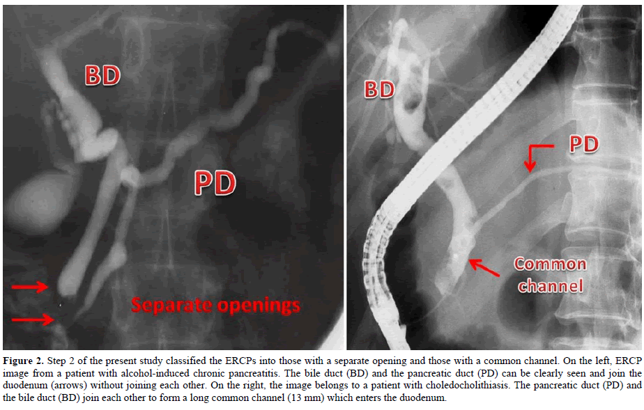 pancreas-step-2-present-study-classified