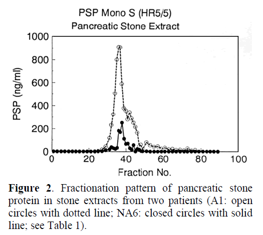 pancreas-stone-extracts-two-patients