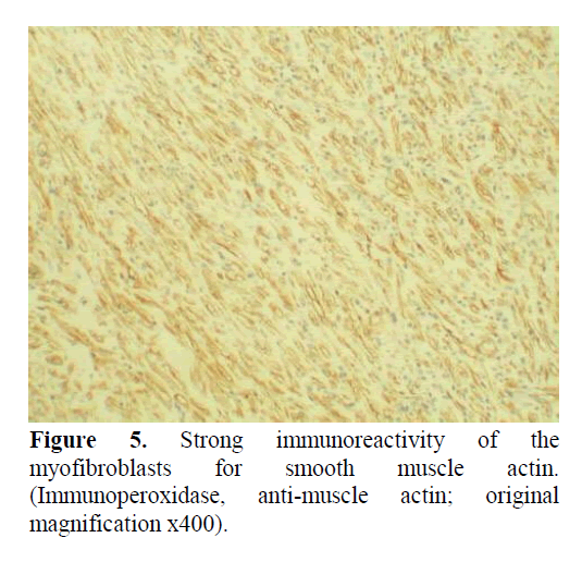 pancreas-strong-immunoreactivity