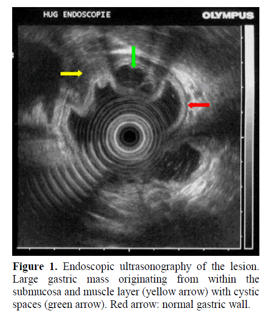 pancreas-submucosa-muscle-layer