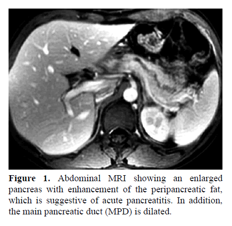 pancreas-suggestive-acute-pancreatitis