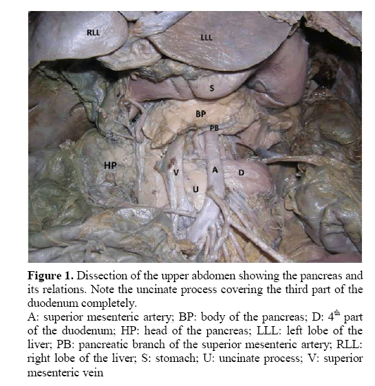 pancreas-superior-mesenteric-artery