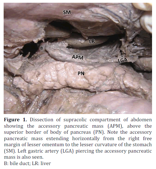 pancreas-supracolic-abdomen-pancreatic