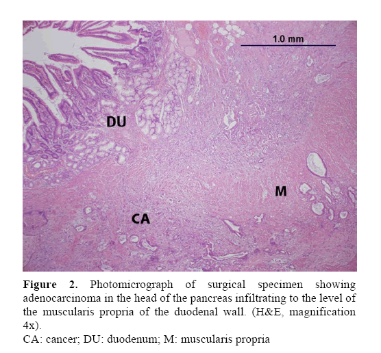 pancreas-surgical-specimen