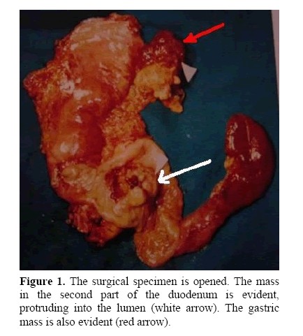 pancreas-surgical-specimen-opened
