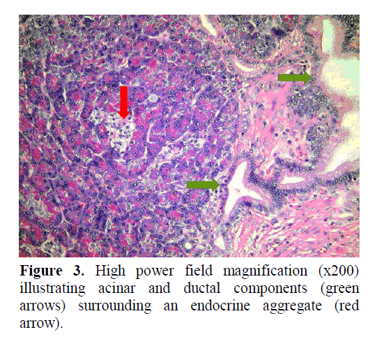 pancreas-surrounding-endocrine-aggregate