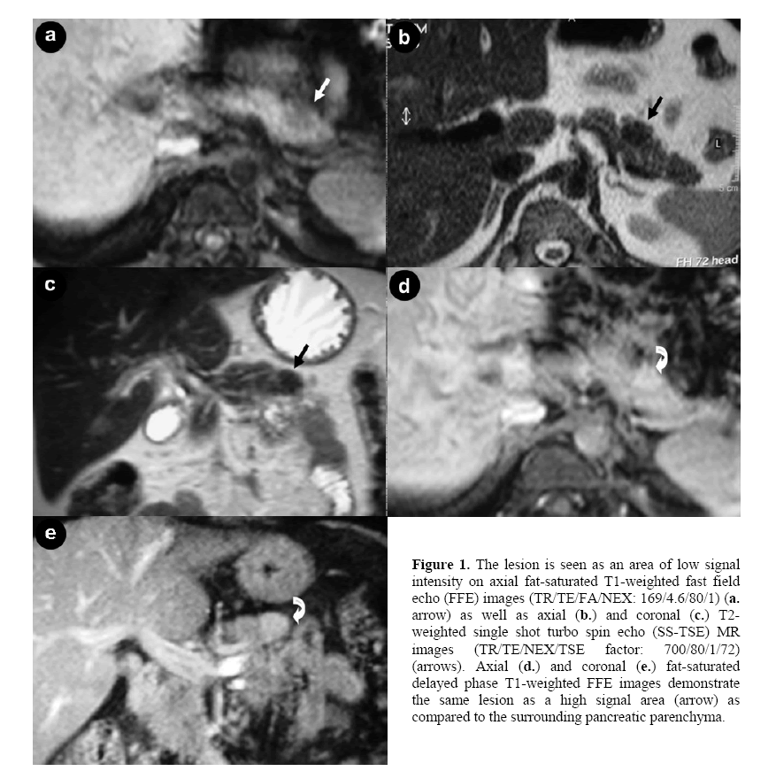 pancreas-surrounding-pancreatic-parenchyma