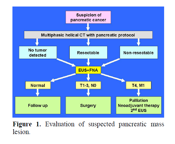 pancreas-suspected-pancreatic-mass