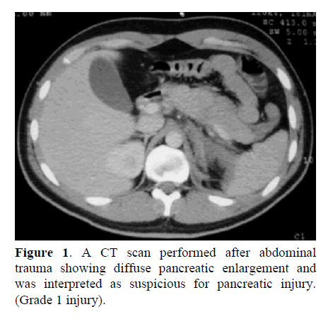 pancreas-suspicious-pancreatic-injury