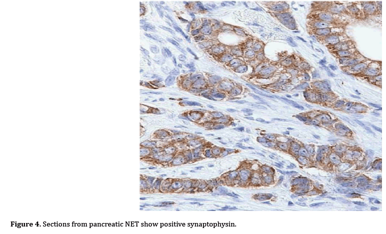 pancreas-synaptophysin