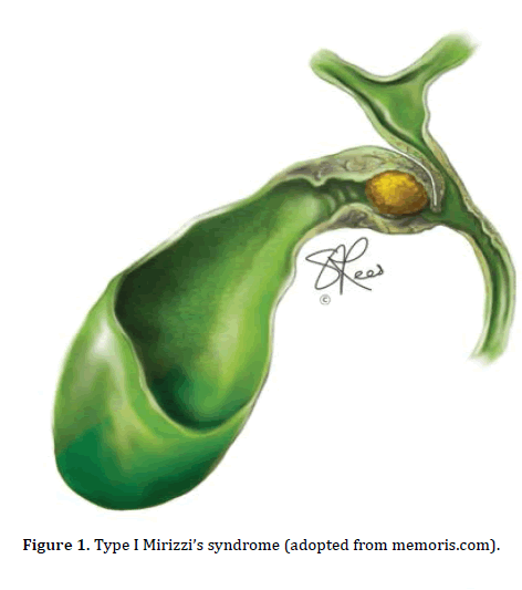 pancreas-syndrome