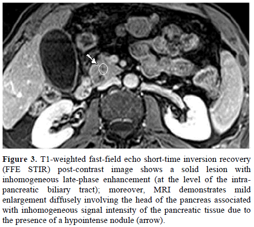 pancreas-t1-weighted-fast-field