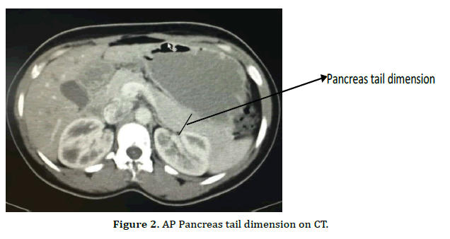pancreas-tail-dimension