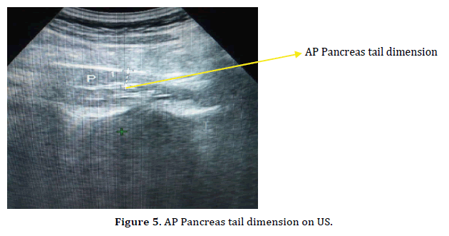 pancreas-tail-dimension