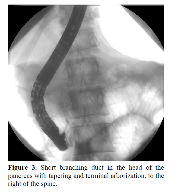 pancreas-tapering-terminal-arborization