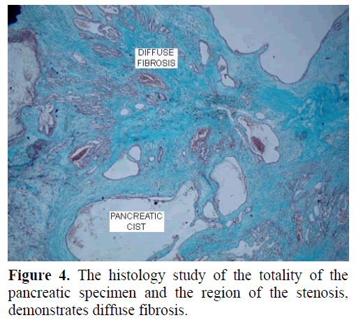 pancreas-the-histology-study-totality