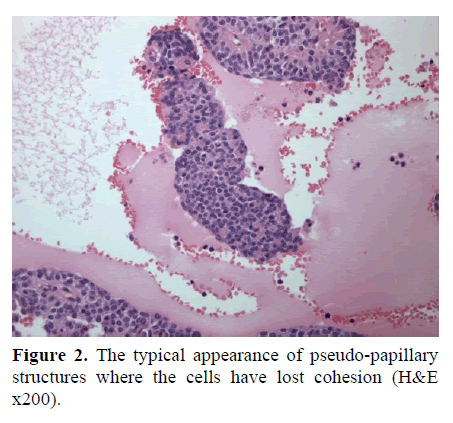 pancreas-the-typical-appearance