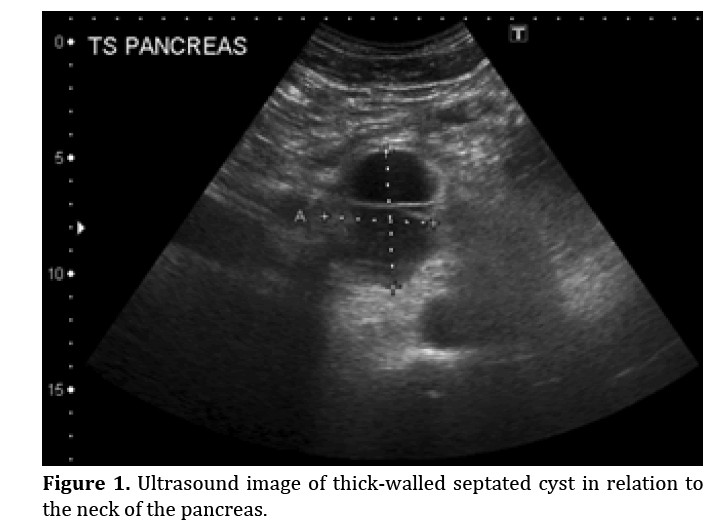 pancreas-thick-walled-septated-cyst