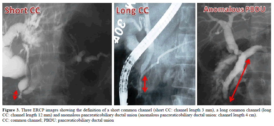 pancreas-three-ercp-images-short-common