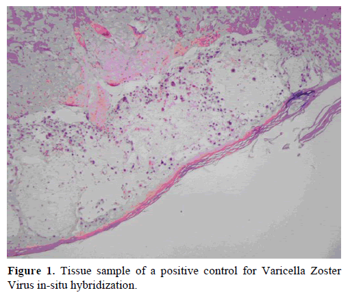 pancreas-tissue-sample-positive-control