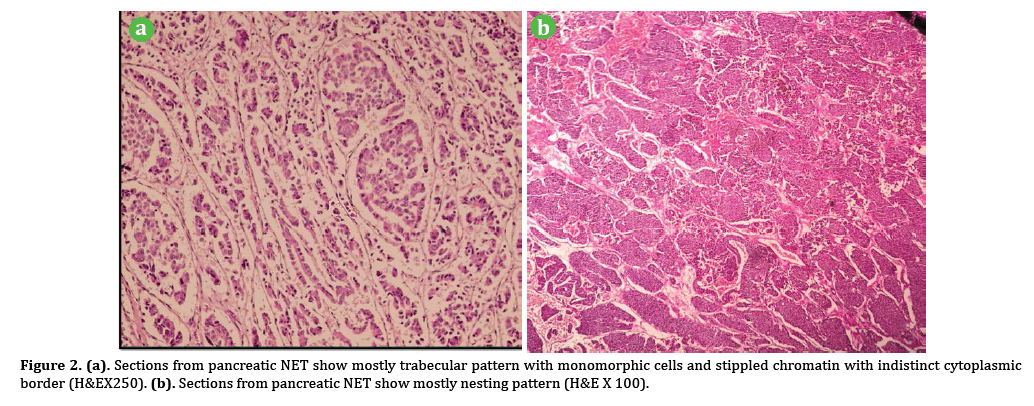 pancreas-trabecular