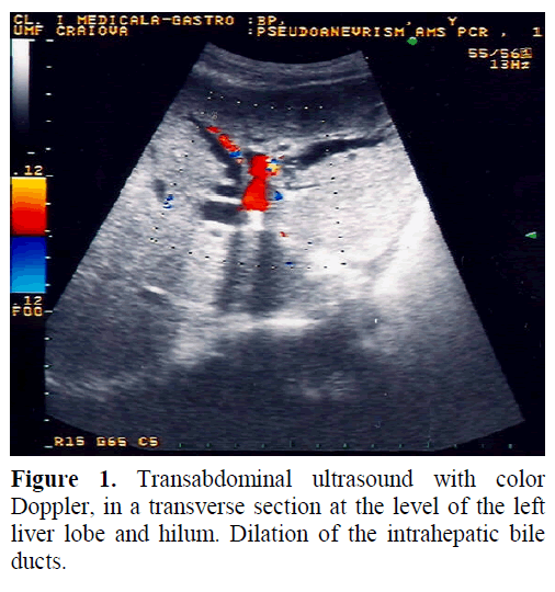 pancreas-transabdominal-ultrasound-doppler