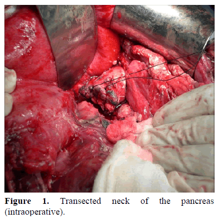 pancreas-transected-neck-pancreas