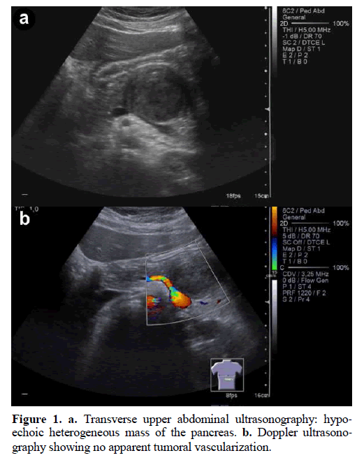 pancreas-transverse-upper-abdominal