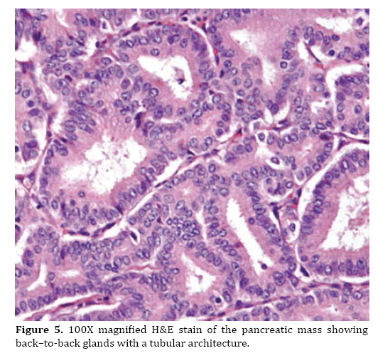 pancreas-tubular-architecture