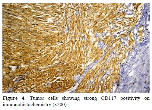 pancreas-tumor-cells-immunohistochemistry