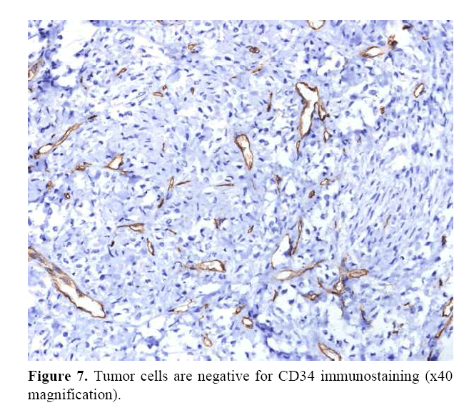 pancreas-tumor-cells-negative