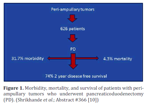 pancreas-tumors-pancreaticoduodenectomy